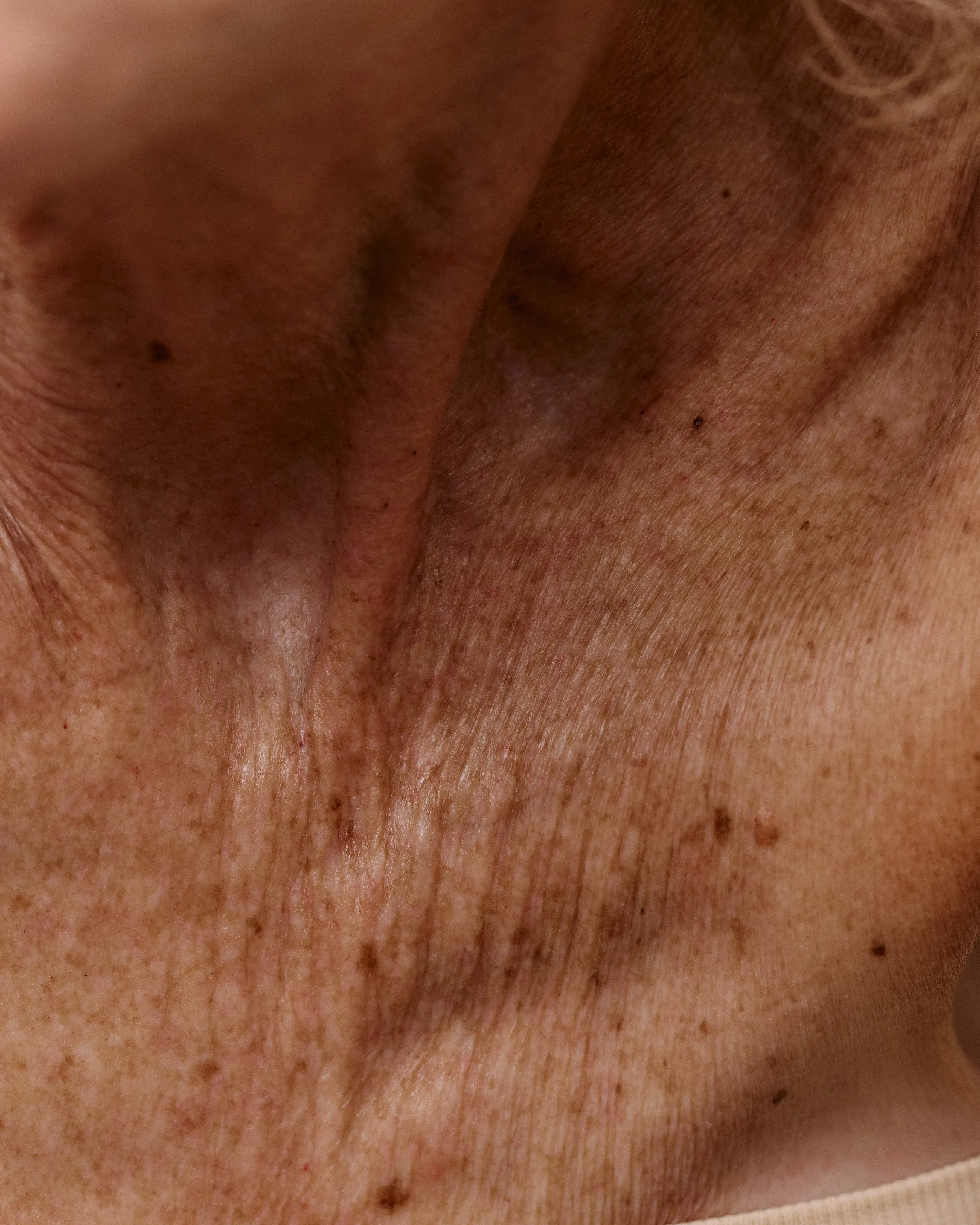 Extreme macro of mature, sun-freckled skin across a collarbone in warm light